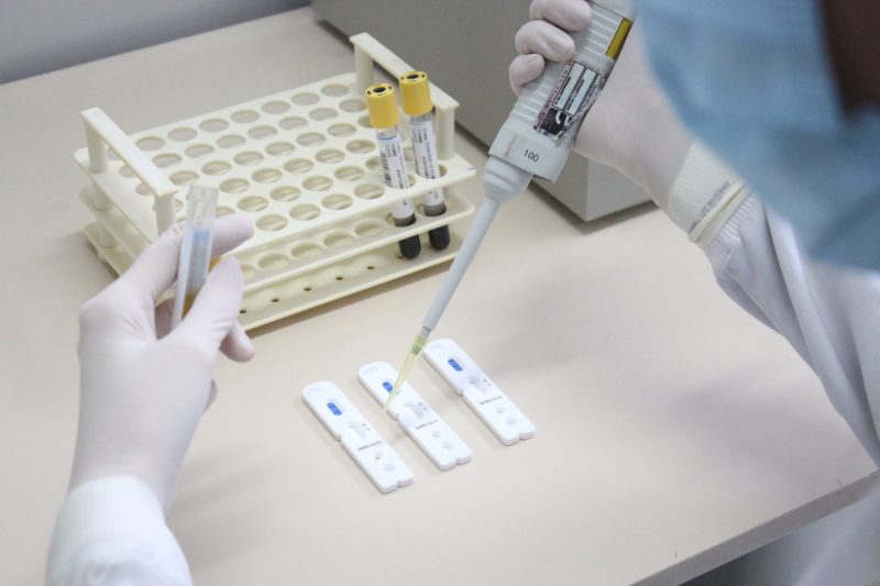 Testes s&atilde;o feitos a pedido do m&eacute;dico, logo ap&oacute;s consulta na unidade de sa&uacute;de – Foto: Prefeitura de Jaragu&aacute; do Sul/Divulga&ccedil;&atilde;o