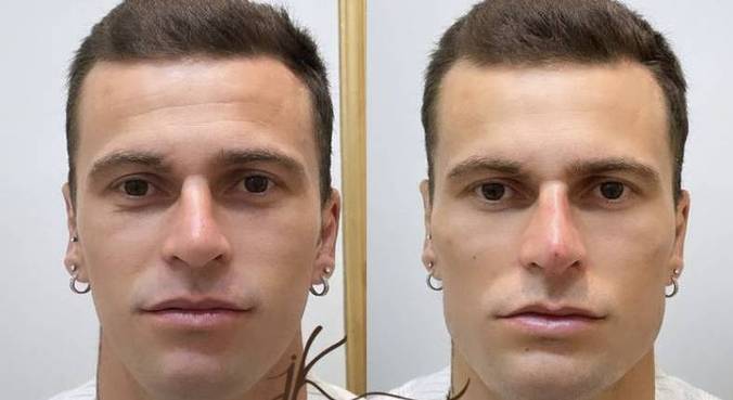 Lucas Lima