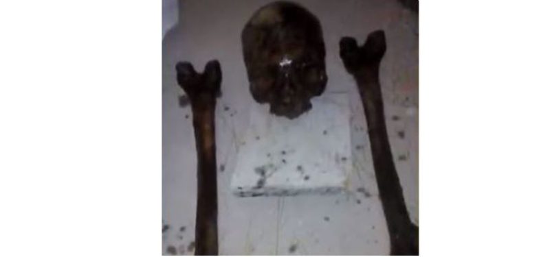 Ossos humanos que foram negociados