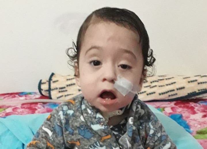 O beb&ecirc; tinha uma condi&ccedil;&atilde;o que exigia o uso de sonda para alimenta&ccedil;&atilde;o – Foto: Arquivo pessoal