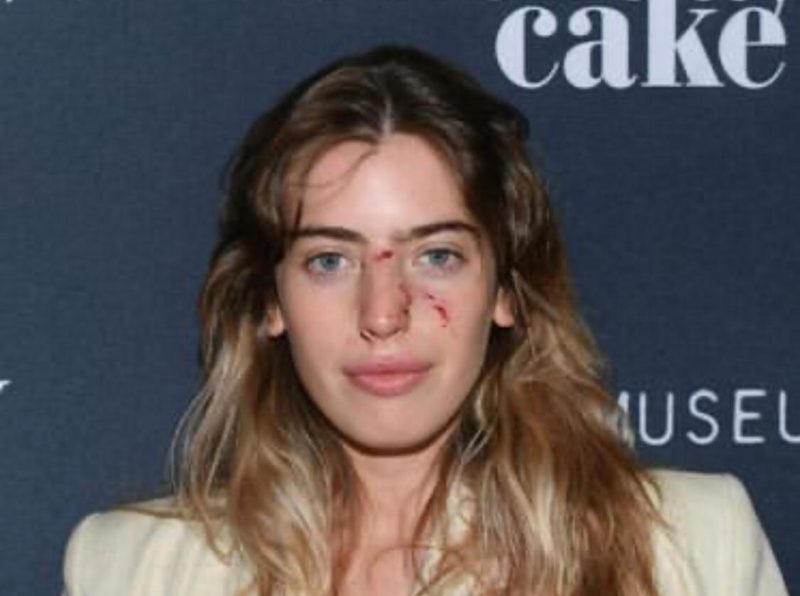 Clara McGregor posou com o rosto machucado no lan&ccedil;amento de seu novo filme – Foto: Reprodu&ccedil;&atilde;o/ Instagram