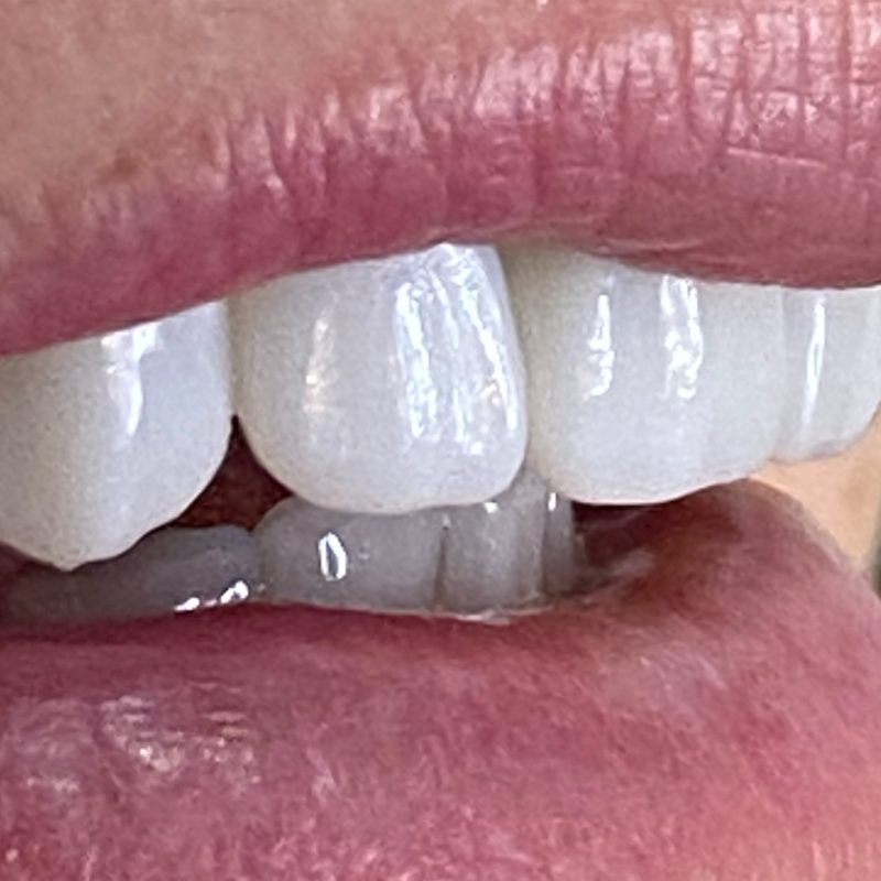 Mais de 400 pessoas já fizeram o procedimento na Oral Visage – Foto: Divulgação Oral Visage