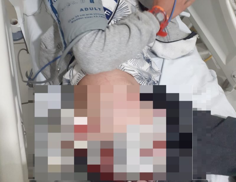 Menino de 11 anos foi atingido por tiro no quadril – Foto: Divulga&ccedil;&atilde;o/ND