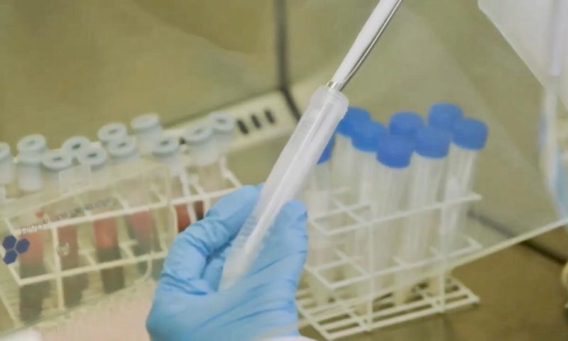 Laboratório de Biologia Molecular da Univille faz testes para detectar Covid-19 e também o sorológico. – Foto: Univille/Divulgação ND