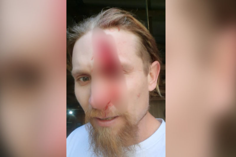 Vereador de Indaial é atingido na cabeça por motosserra – Foto: Arquivo Pessoal/Redes Sociais