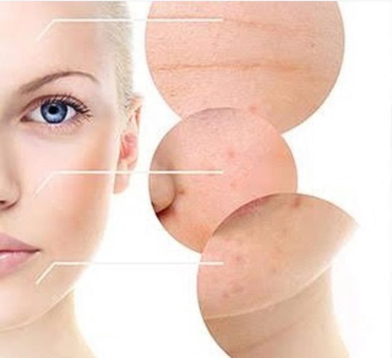 Já ouviram falar em Fisioterapia Dermatofuncional? Confira tudo aqui