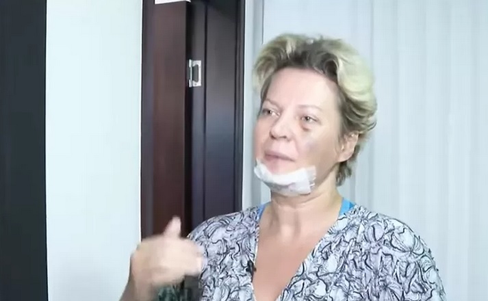 Deputada federal Joice Hasselmann (PSL-SP) diz ter sofrido atentado – Foto: Reprodu&ccedil;&atilde;o/CNN
