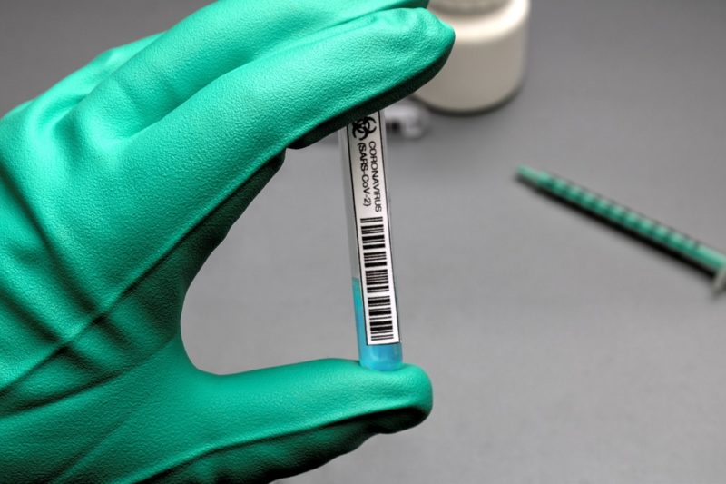 Testes que detectam a Covid-19 ajudam na contenção da proliferação da doença, e nas medidas protetivas dos infectados, na tentativa de evitar que situações de morte aconteçam – Foto: Pixabay/Divulgação/ND