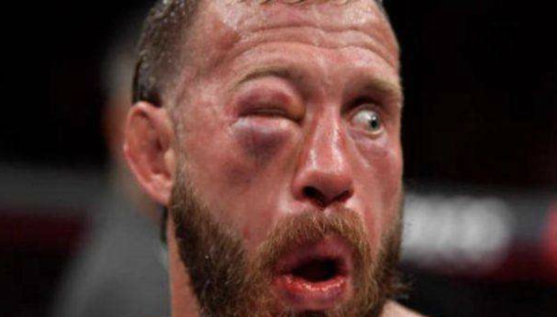 Donald Cerrone não está piscando para você. Trata-se o olho fechado de tanto tomar pancada na derrota para Tony Ferguson, em 20219 – Foto: Reprodução