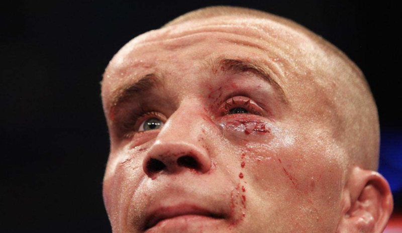 Pode apostar que Matt Homenick saiu com dor de cabeça após a derrota para o brasileiro José Aldo, em 2011, valendo o cinturão do peso pena – Foto: Reprodução