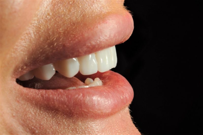 Um sorriso belo é um sorriso funcional – Foto: Divulgação Oral Visage
