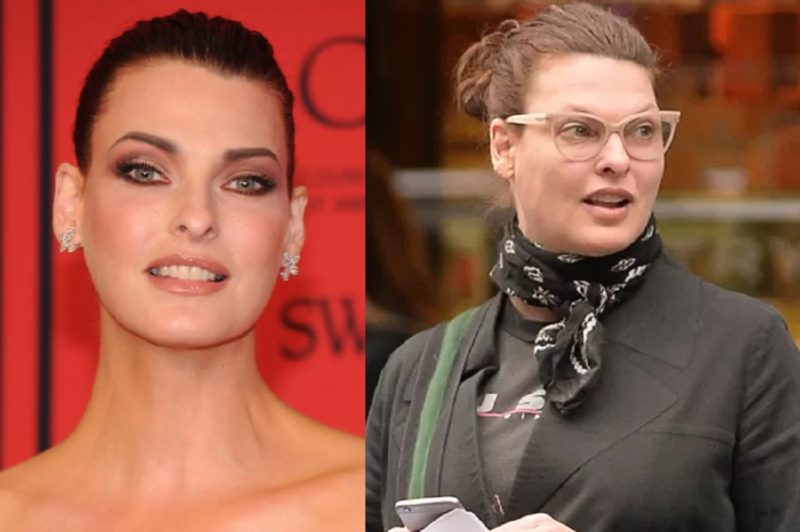 Conheça o procedimento estético que desfigurou e 'sumiu' com top model  Linda Evangelista