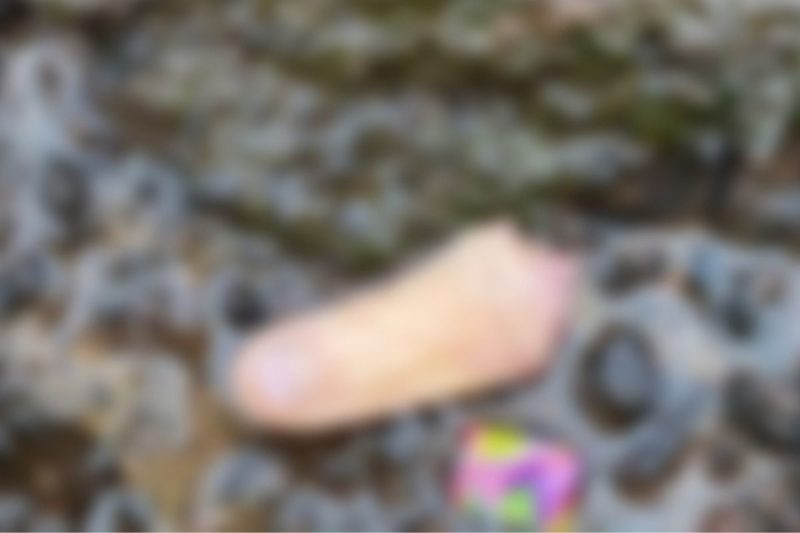 Cachorro voltou pra casa carregando dedo humano na boca – Foto: Reprodu&ccedil;&atilde;o/Internet