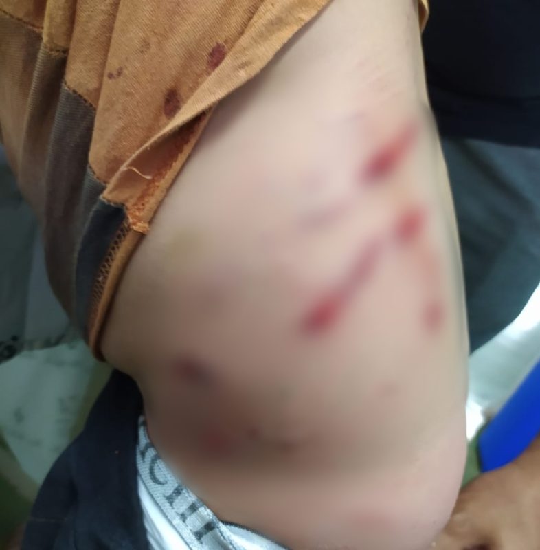 Crian&ccedil;a de 7 anos &eacute; atacado por c&atilde;es na frente de casa em Curitibanos – Foto: Arquivo Pessoal/ND