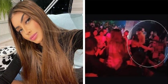 Cantora foi atingida por copo de bebida durante show em Florian&oacute;polis – Foto: Reprodu&ccedil;&atilde;o/Instagram