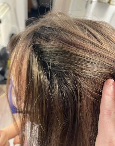 Sal&atilde;o conseguiu resolver o problema da menina – Foto: Reprodu&ccedil;&atilde;o/Facebook(Linzi Bone Hair)