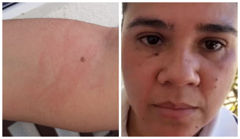 Mulher fica presa em porta de ônibus – Foto: Acervo pessoal
