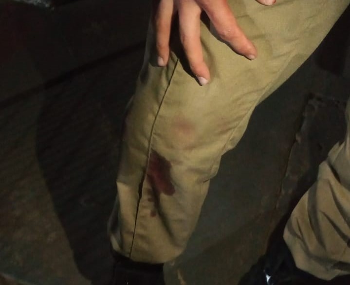 Policiais foram agredidos pelo homem e sofreram cortes no joelho – Foto: PM/ND