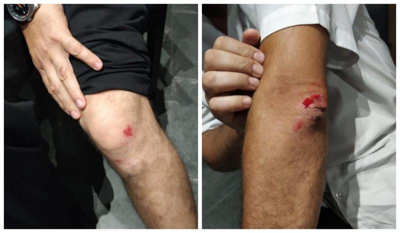 ferimentos do segurança