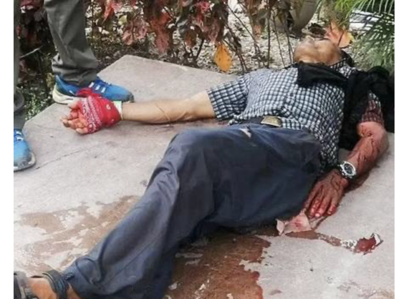 Agentes amarraram um lençol no braço do turista, que deitou no chão enquanto aguardava os paramédicos &#8211; Foto: Reprodução