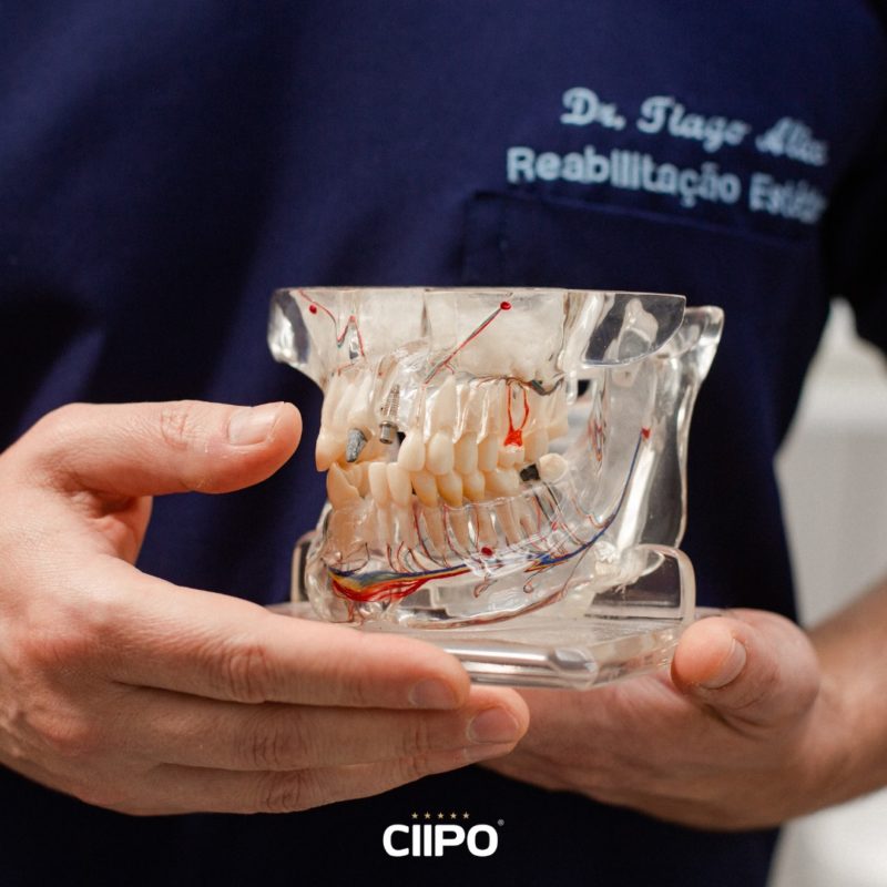 Dr. Tiago Alice demonstra formas de tratamento dent&aacute;rio – Foto: Divulga&ccedil;&atilde;o CIIPO S&atilde;o Jos&eacute;