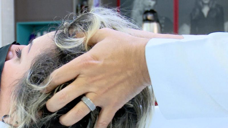 Uma das sequelas da Covid-19, a queda de cabelo, tem tratamento &#8211; Foto: Thiago Bonin/NDTV