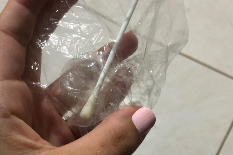 Moradora de Joinville conta que ficou quase 24 horas com parte da haste no nariz – Foto: Arquivo pessoal