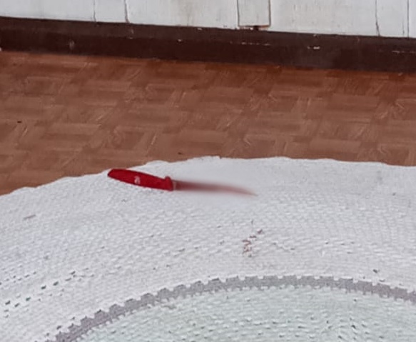 Homem foi agredido com golpes de faca. – Foto: Pol&iacute;cia Civil/Divulga&ccedil;&atilde;o/ND