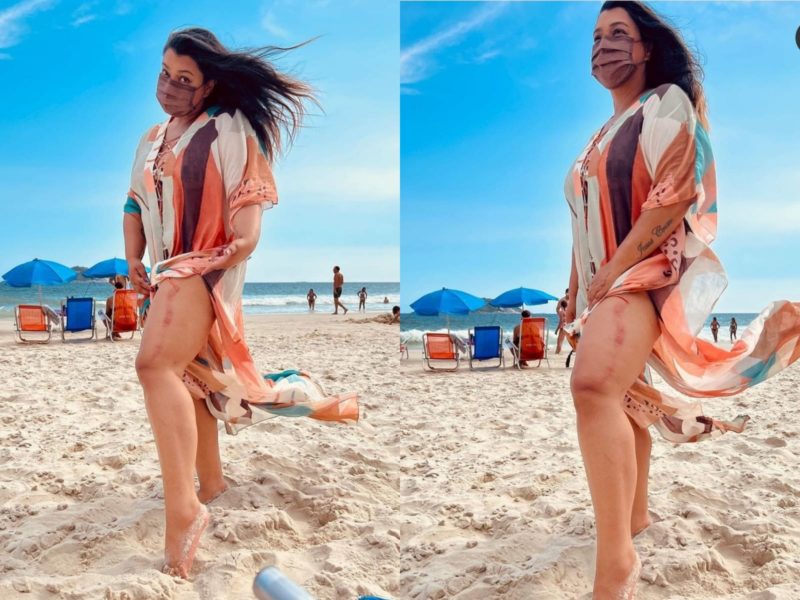 Preta Gil &eacute; atingida por barraca em praia no Rio de Janeiro – Foto: Reprodu&ccedil;&atilde;o/Internet