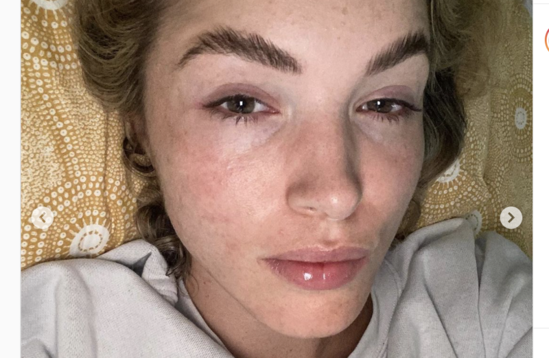 Olivia sofre ainda com resqu&iacute;cios da doen&ccedil;a, mas nada pior do que n&atilde;o parar de arrotar desde ent&atilde;o – Foto: Reprodu&ccedil;&atilde;o