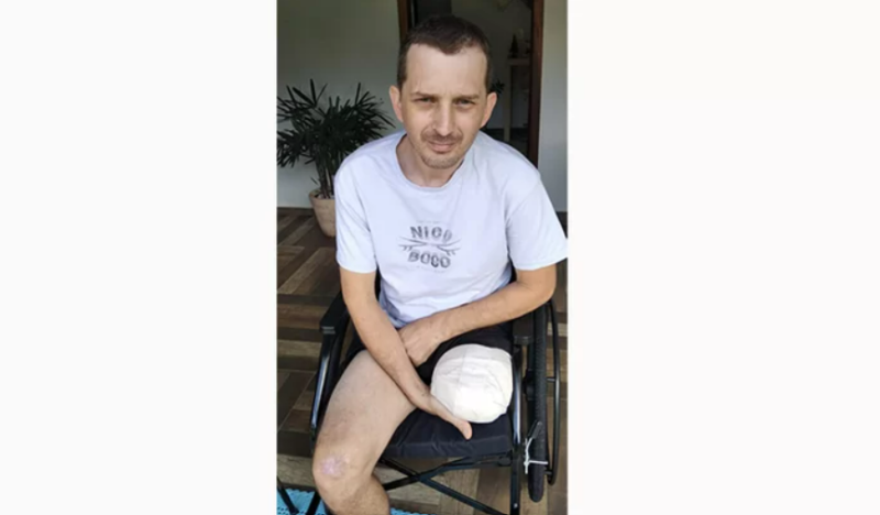 Silvano sofreu grave acidente em Blumenau e teve a perna esquerda amputada – Foto: Divulga&ccedil;&atilde;o/ND