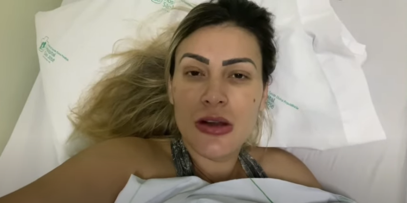 Andressa Urach, a eterna ex-vice miss bumbum, fez aplicações de hidrogel nas pernas. Acabou internada, chegando a correr sério risco de morte. Tudo para ganhar mais coxas, lá por volta de 2014. “Não desejo a dor e o desespero que passei nem ao meio pior inimigo” – Foto: Reprodução/Internet