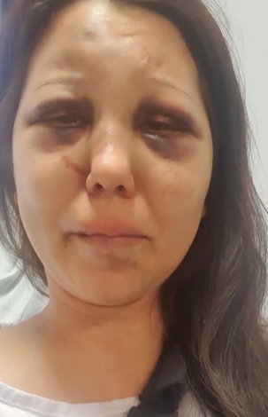 A moradora conta que o agressor tentou estupr&aacute;-la na frente dos filhos – Foto: Reprodu&ccedil;&atilde;o V&iacute;deo