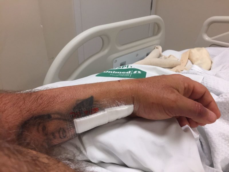 A v&iacute;tima passou por cirurgias e ficou com os bra&ccedil;os engessados – Foto: Arquivo pessoal/Divulga&ccedil;&atilde;o/ND