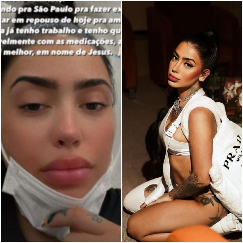 A cantora falou sobre a ansiedade no &uacute;ltimo domingo (6) atrav&eacute;s das redes sociais – Foto: Reprodu&ccedil;&atilde;o/Instagram