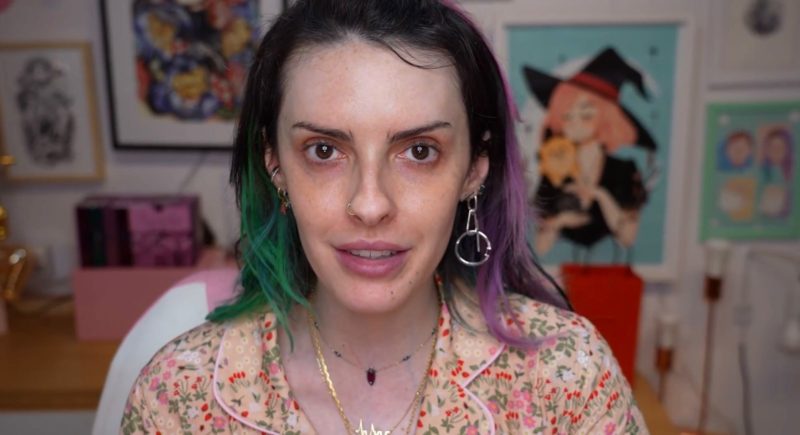 Karen Bachini fala sobre condi&ccedil;&atilde;o que afeta 1% das mulheres – Foto: Internet/Divulga&ccedil;&atilde;o/ND