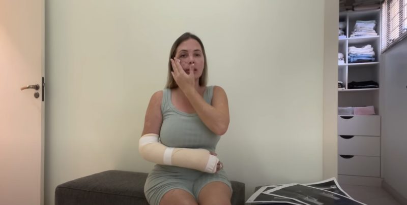 Musa das Estradas mostra resultado da cirurgia no rosto