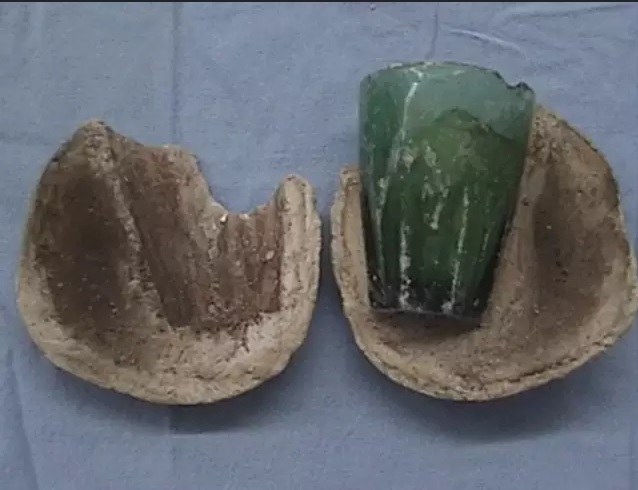 Copo estava dentro da bexiga de mulher 