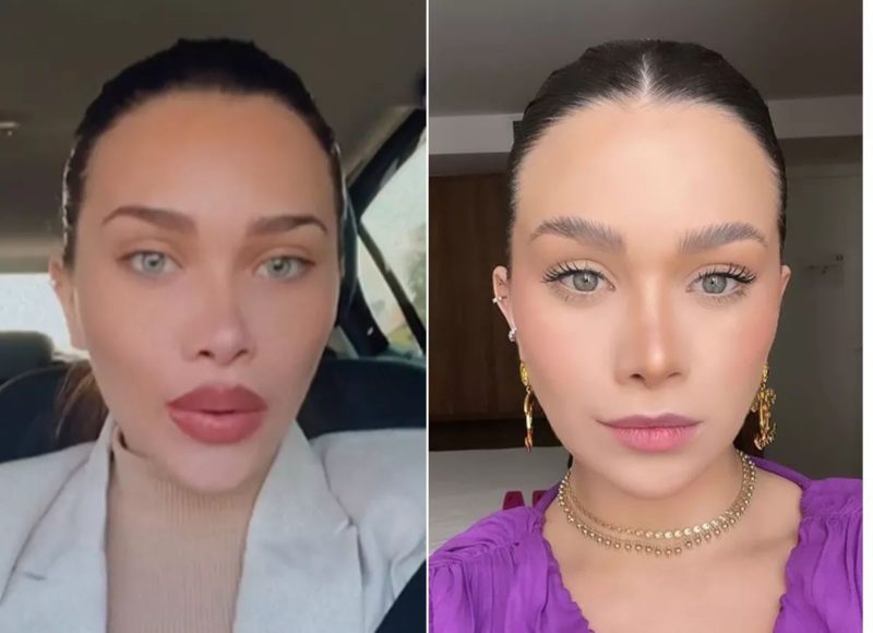 Flávia Pavanelli retirou seu preenchimento labial para voltar a se sentir “natural”