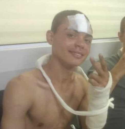 Fernando Veloso &eacute; um dos sobreviventes do acidente grave com caminh&atilde;o do 23&deg; BI – Foto: Divulga&ccedil;&atilde;o/ND