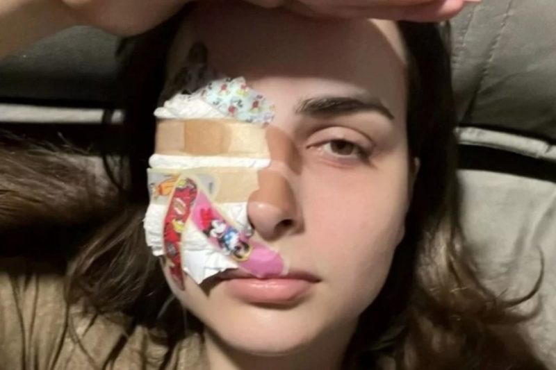 Influenciadora rasgou c&oacute;rnea ao co&ccedil;ar o olho – Foto: Internet/Reprodu&ccedil;&atilde;o