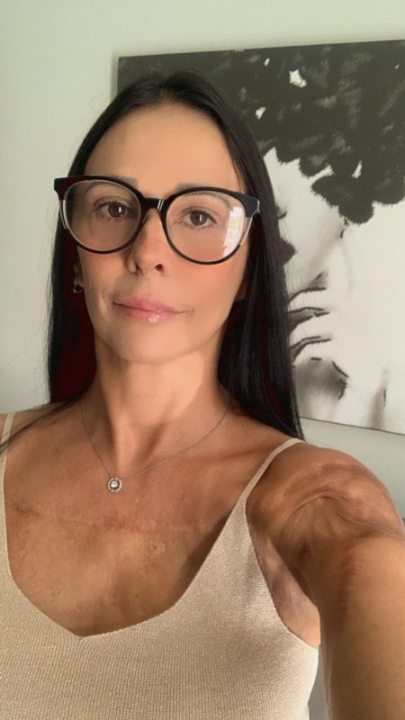 Ap&oacute;s in&uacute;meras cirurgias, Maristela pede que justi&ccedil;a seja feita. – Foto: Arquivo pessoal/Maristela Stringhini/ND