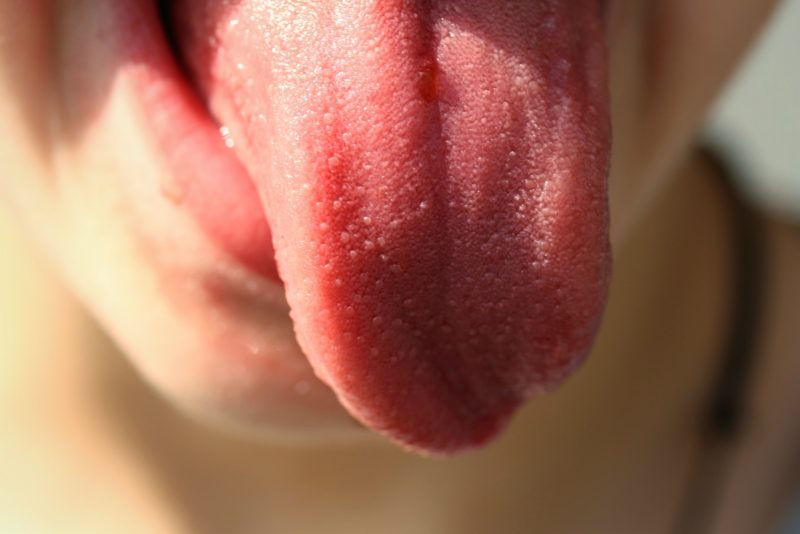 Foto: Una rara enfermedad que deja la lengua de un hombre negra y «peluda».  entender porqué