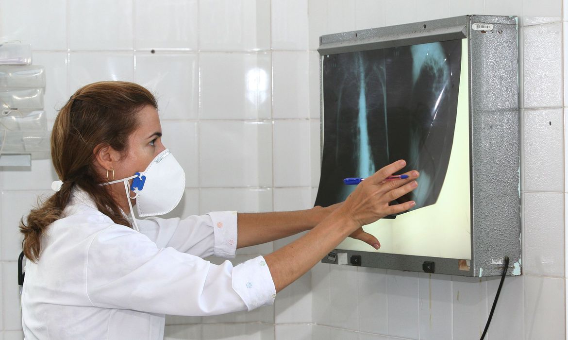 Com 1.794 novos casos de tuberculose em SC em 2021, mortes pela doença  crescem desde 2017