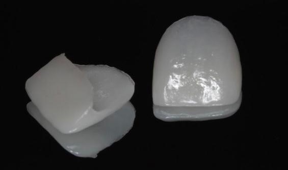 Lentes de contato ou facetas dentais são pequenos fragmentos de cerâmica &#8211; Foto: Divulgação