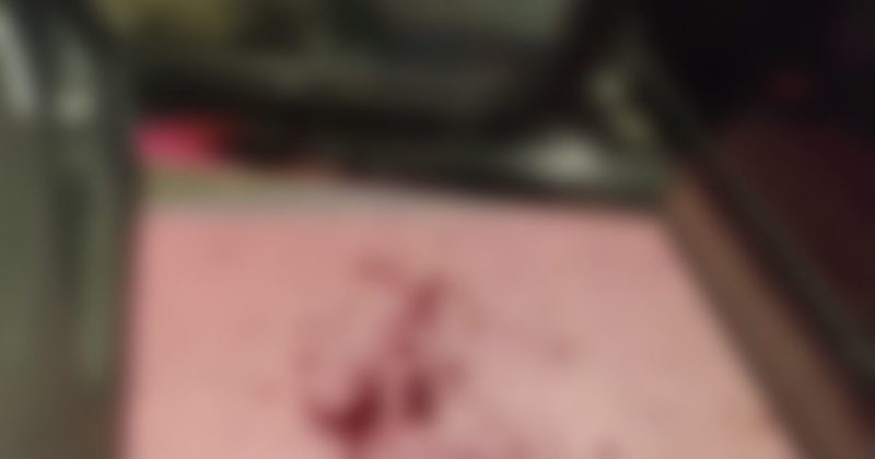 Homem levou tiro no rosto enquanto dirigia no bairro Cordeiros em Itaja&iacute; – Foto: Pol&iacute;cia Militar Itaja&iacute;/Divulga&ccedil;&atilde;o