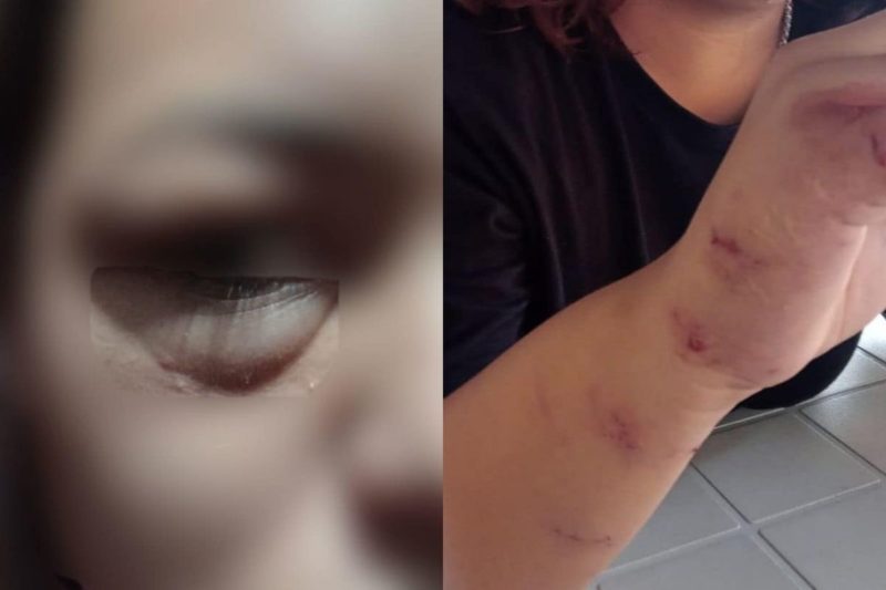 Filha de Prycilla ficou com v&aacute;rios ferimentos ap&oacute;s a agress&atilde;o – Foto: Prycilla Bianchi/Arquivo pessoal