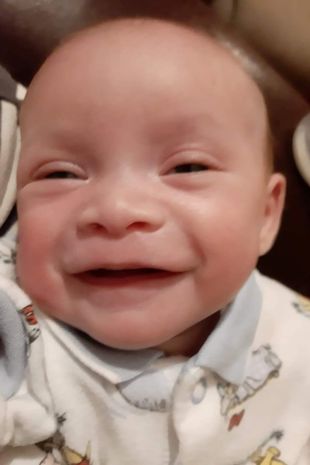 A mãe disse que sua filha não parecia assustadora depois de nascer – Foto: Reprodução/Internet/ND
