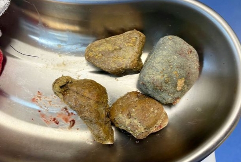 V&aacute;rias pedras foram encontradas no est&ocirc;mago da labradora – Foto: Divulga&ccedil;&atilde;o/Stoke Sentinel