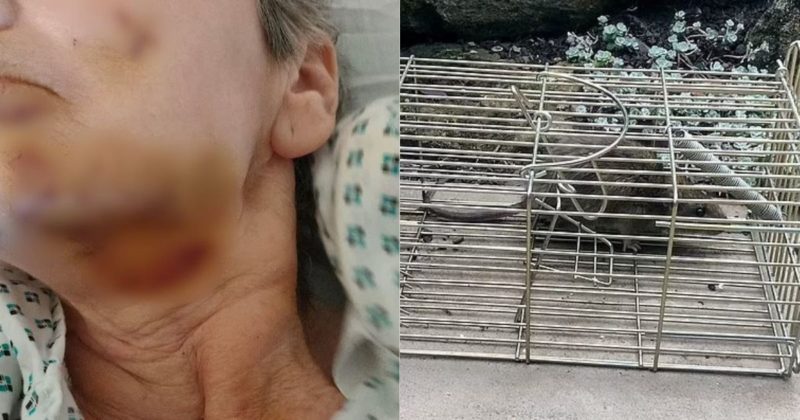 Idosa foi brutalmente atacada por ratazana enquanto dormia – Foto: Reprodu&ccedil;&atilde;o/Daily Mail